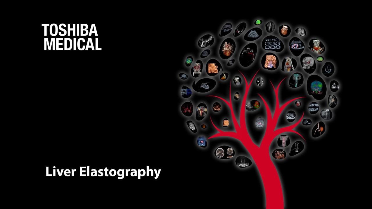 Liver Elastography - A Teaching Hospital Experience with Marilyn Zelesco