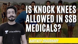 Knock Knee - Easy Treatment with Exercise for Indian Armed Forces | Kartikey Chaudhary