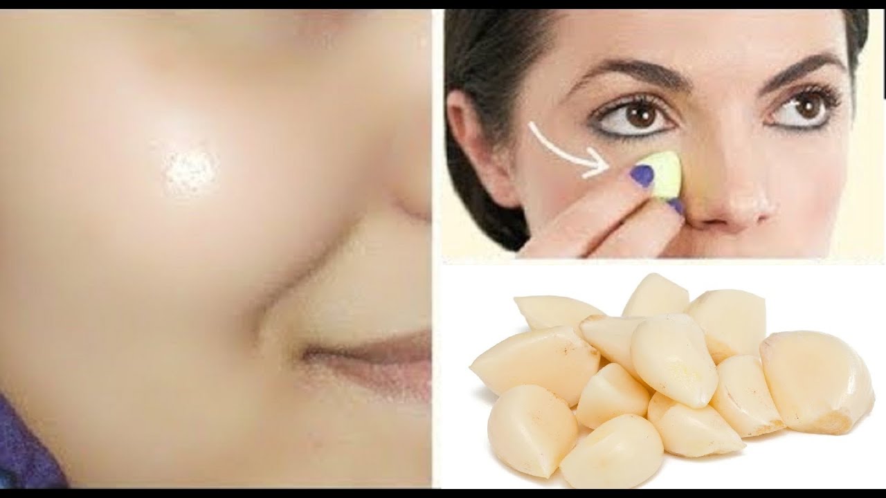 بو تاکس خانگی با سیر