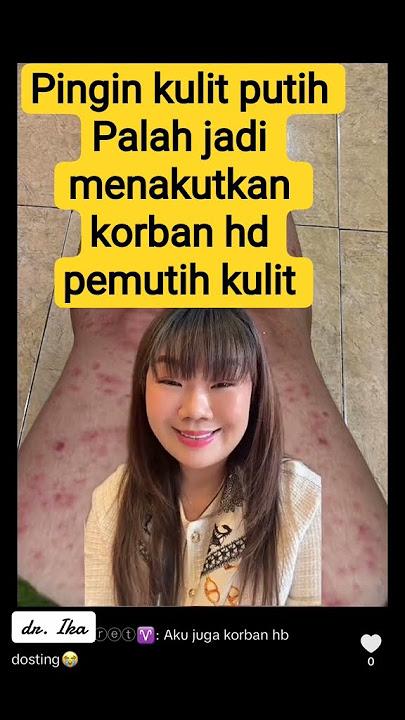 niatnya pingin kulit putih palah jadi menakutkan korban hd pemutih kulit Abal Abal #shourts#vidio#