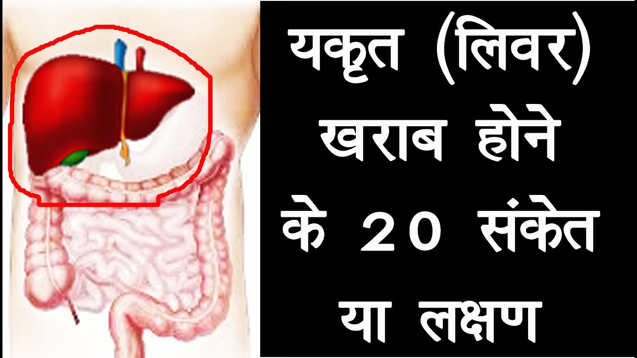 लिवर ख़राब होने के 20 लक्षण liver kharab hone ke 20 lakshan यकृत