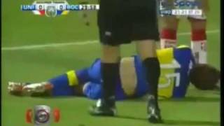 FRACTURA DE TIBIA Y PERONE DE NICOLAS COLAZO- BOCA vs UNION