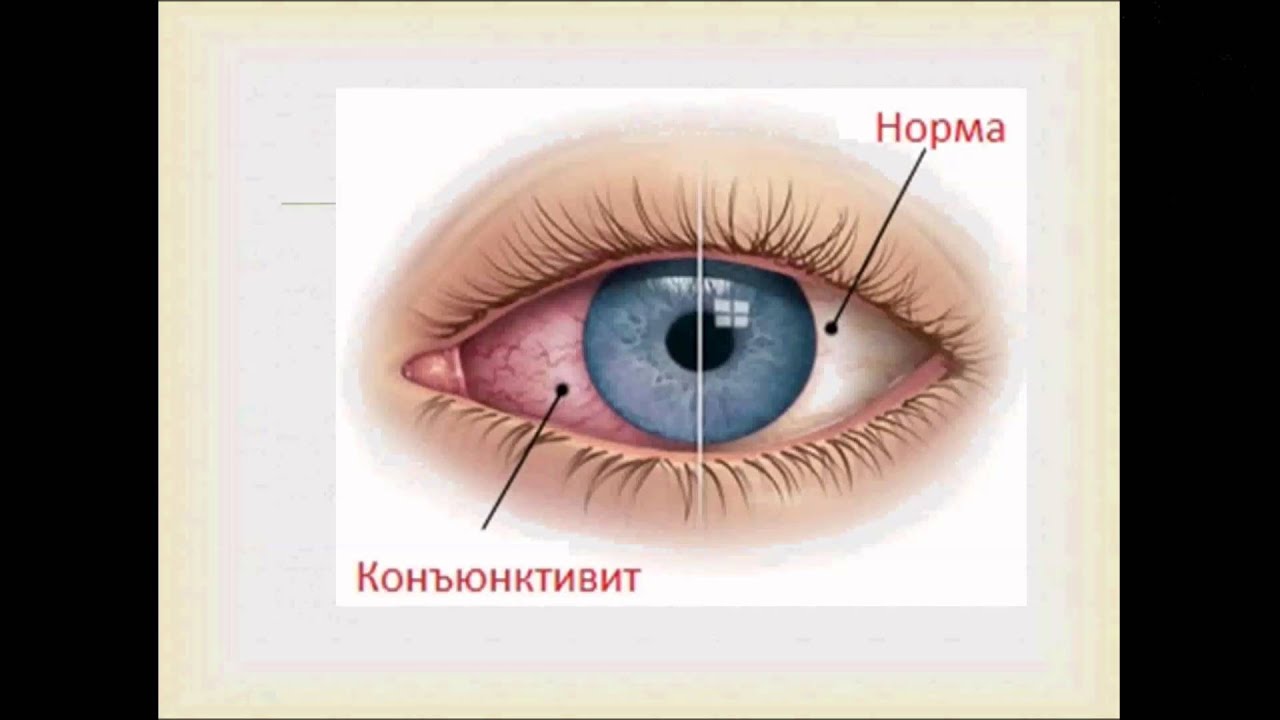 Конспект урока сбо гигиена зрения