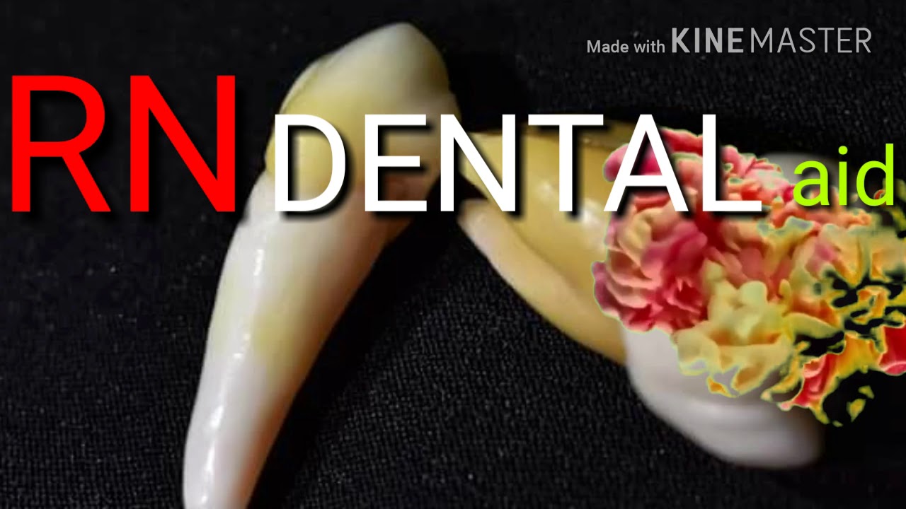 RN DENTAL aid  VIDEO