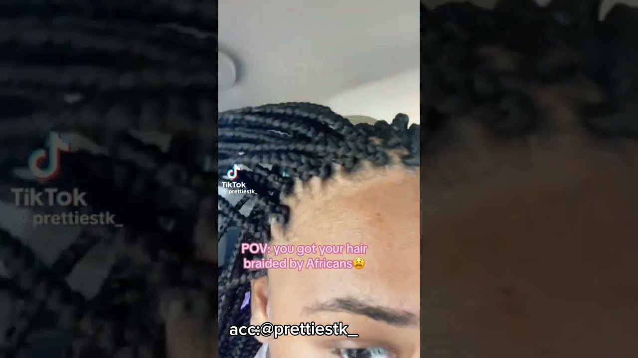 PSA To Girls Tight Braids Can Cause Balding And Scalp Damage Tightbraids Braid Warning