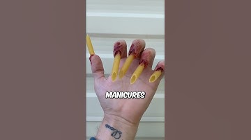 Cutting Off an Extra Finger?! 🔪 (@sfxbydavid on TikTok) #shorts