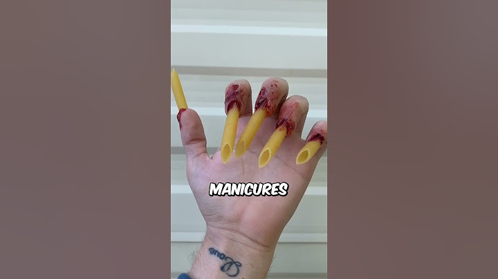 Cutting Off an Extra Finger?! 🔪 (@sfxbydavid on TikTok) #shorts