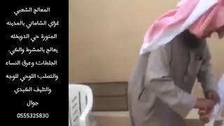 المعالج الشعبي /غزاي الشاماني. يعالج بالمشرط والكي.