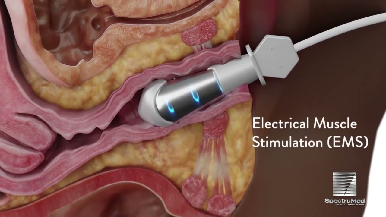 Empower RF by Inmode Modes of Action