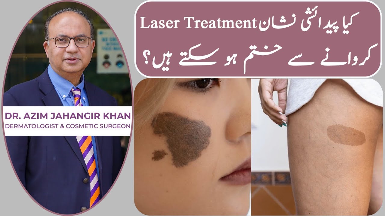 Laser Treatment In Lahore Pakistan Youtube