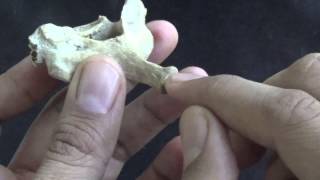 Seventh cervical vertebra - The Vertebra Prominens