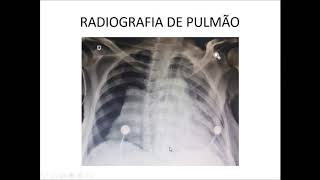 Curso de Radiografia de tórax: Aula VIII Curso de Radiografia de tórax: Aula VIII