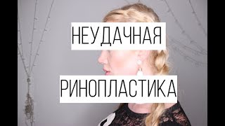 УЖАСЫ НЕУДАЧНОЙ РИНОПЛАСТИКИ