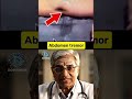 Abdominal Tremor| Best app for NEET PG Preparation |Dopamine|