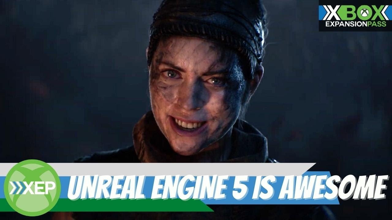 Xbox Expansion Pass 170: Unreal Engine 5 | Respawn's New Studio & Star