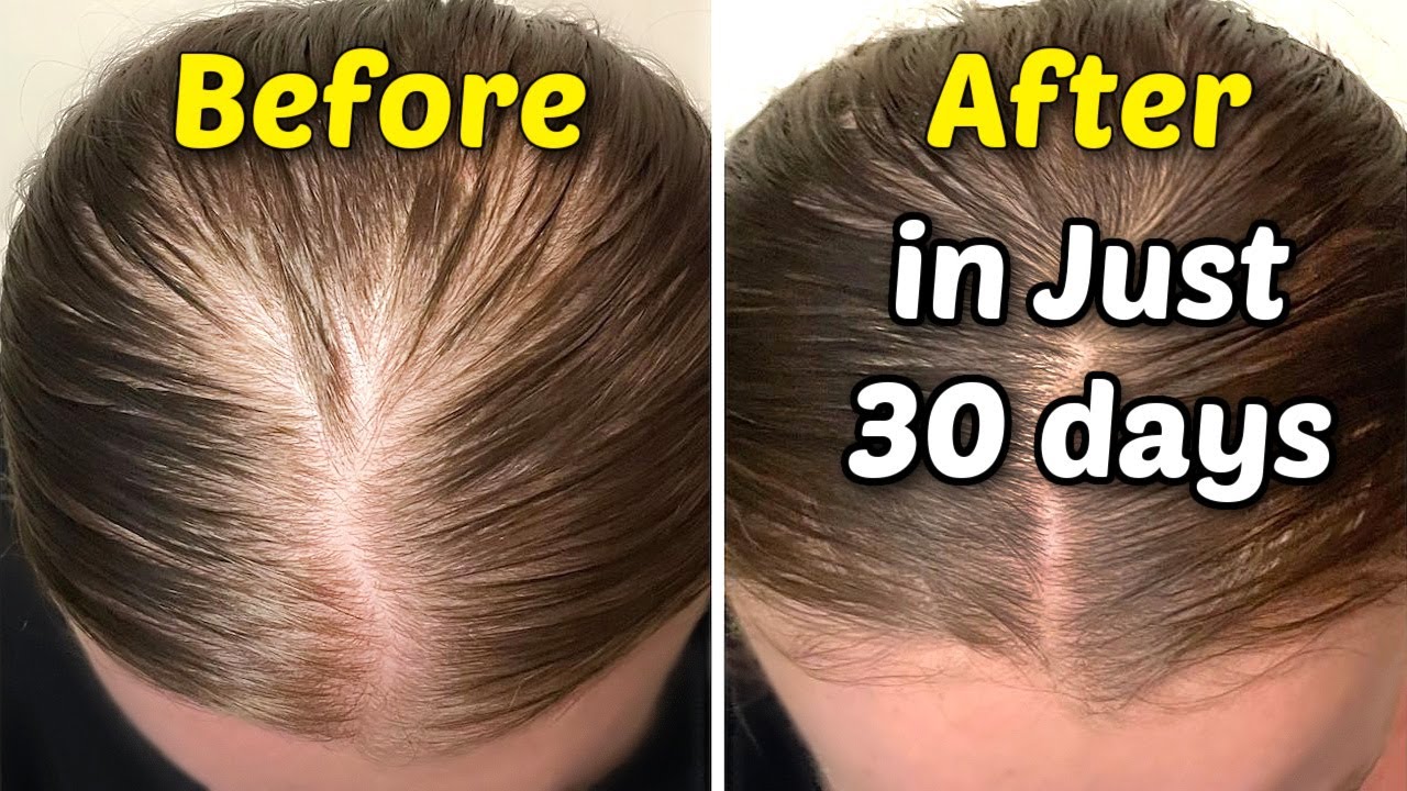 very thin hair to thick hair : Get Thicker Hair In 30 Day! how to get ...