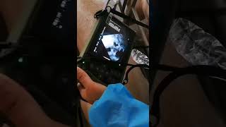 Ultrasound scanner for pigs