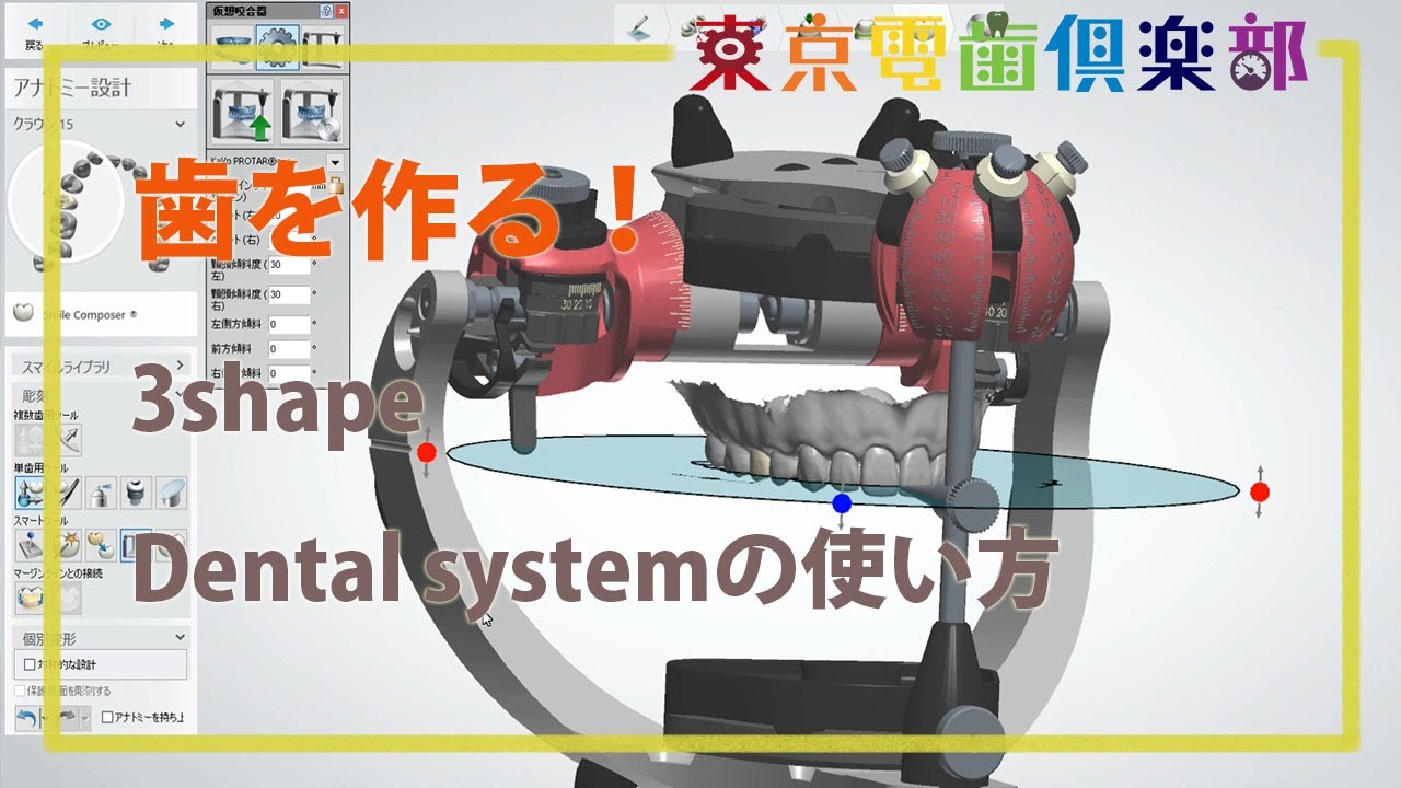 歯を作る　3shape Dentalsystemの使い方　歯科医もCADソフトを使う時代がやって来た！