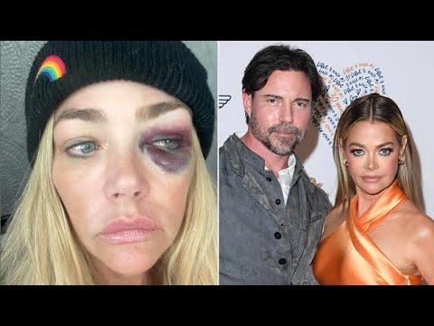 Denise Richards: Leaked Photos Uncensored - The Truth Exposed!