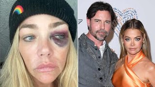 Denise Richards Accuses Ex of Leaking Nudes and Breaking Court Order