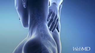 How Bad Posture Can Impact Your Health Webmd