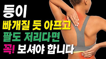 Thumbnail of 등 통증, 팔 저림이 동시에 오는 원인 4가지와 자가 해결법! (전방흉추, T4 증후군, 압박골절, 흉추 디스크) 등통증/견갑골통증/능형근통증/전방흉추증후군