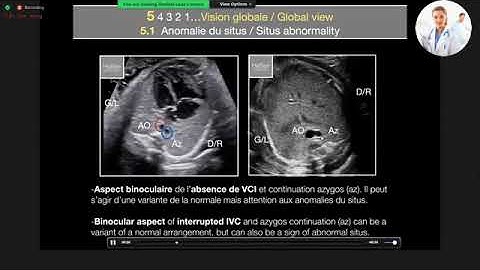 SIÊU ÂM TIM THAI BÌNH THƯỜNG VÀ BẤT THƯỜNG | Daniela Laux, MD
