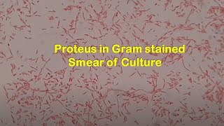 Proteus mirabilis in Gram Stained smear of culture