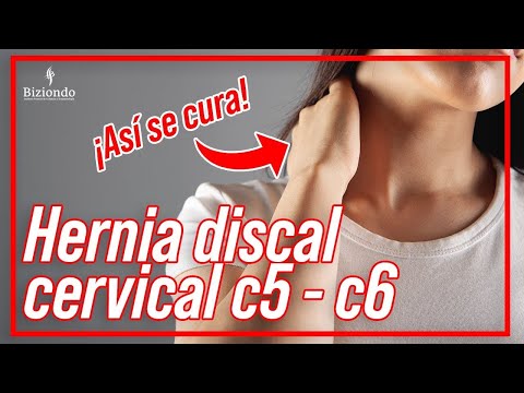 Tengo una HERNIA