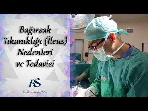 Bağırsak Tıkanıklığı (İleus) Nedenleri ve Tedavisi