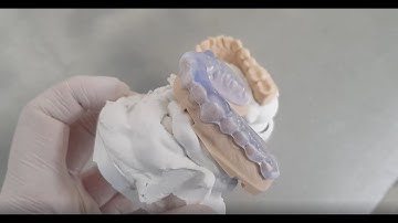 The new innovative 3D printing material KeySplint Soft