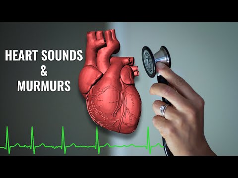 Video: Cum să diagnosticați un murmur cardiac: 13 pași (cu imagini)