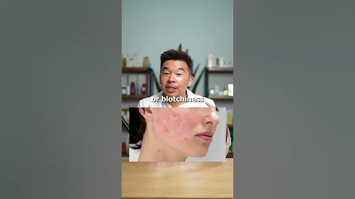 How to identify damaged skin barrier