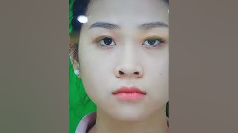 TÁI KHÁM DỊCH VỤ NÂNG MŨI Ở SÀI GÒN VENUS