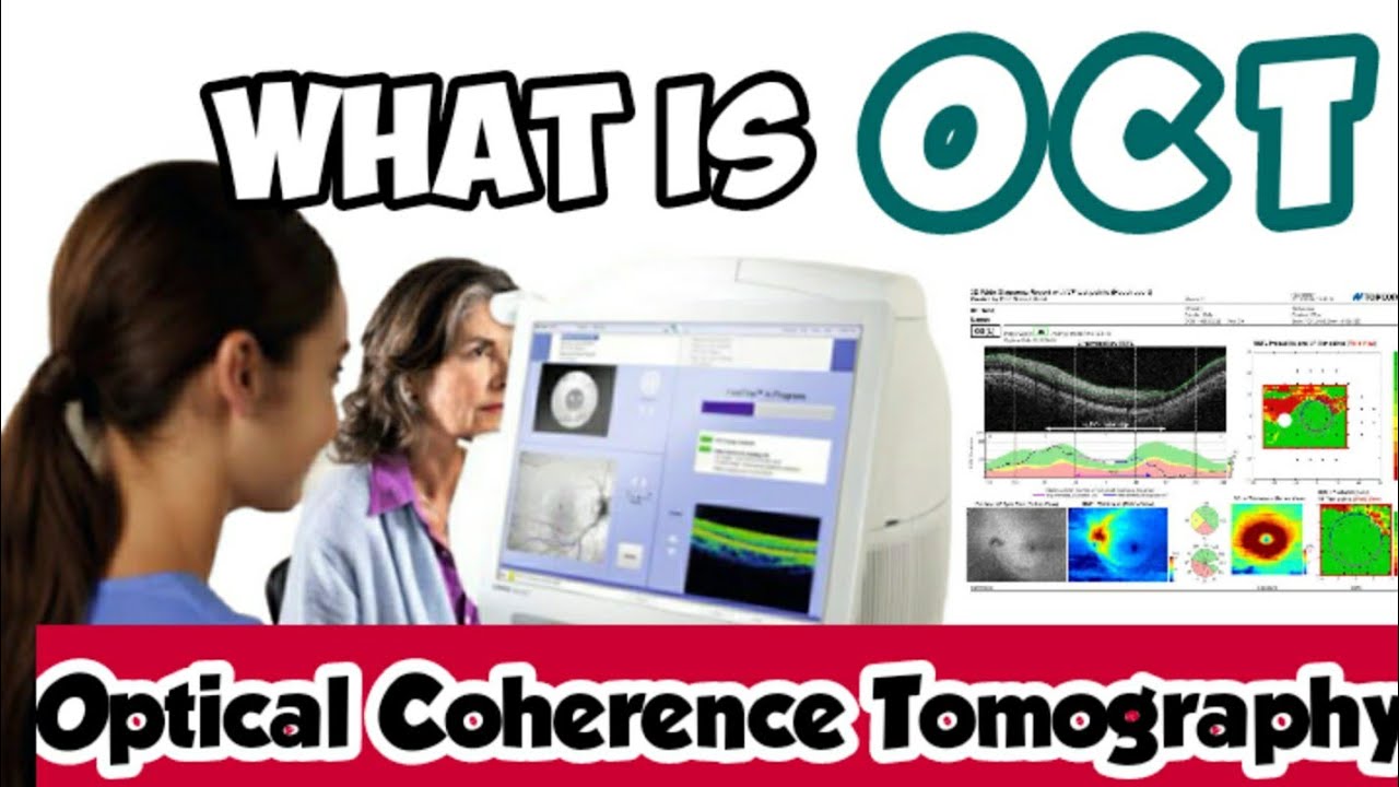 What is OCT - Optical Coherence Tomography | Optometry World - YouTube