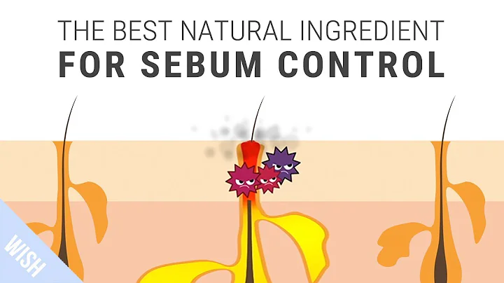 How To Control Excessive Sebum That Leads To Acne | SKINMISO I'm A. Helper - DayDayNews