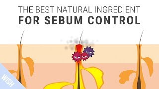 How To Control Excessive Sebum That Leads To Acne | SKINMISO I'm A. Helper