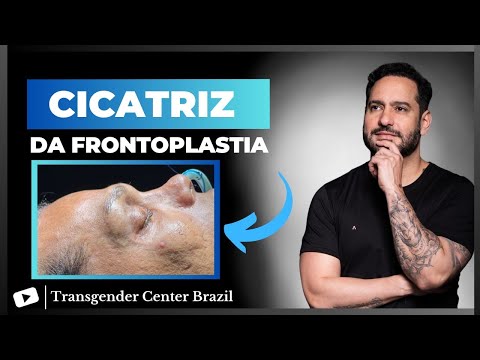 REDESIGNAÇÃO SEXUAL Transgender Center Brazil 