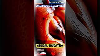 #heartbeat #fastheartbeat #heartritham | 03 screenshot 5