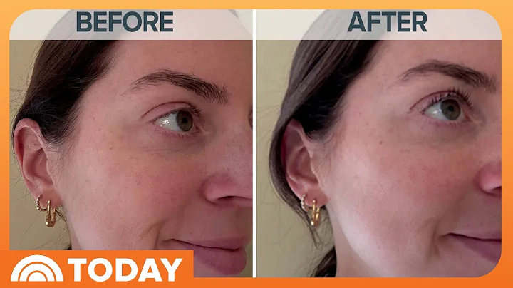 Dermatologist Shares Benefits of Peptides for Skincare Routine