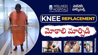 Video thumbnail —  Knee Replacement Success Story 