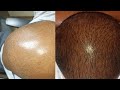 எந்த product பயன்படுத்தியு உங்களுக்கு hair falling குறையவில்லையா?@VijayTelevision@MadrasSamayal