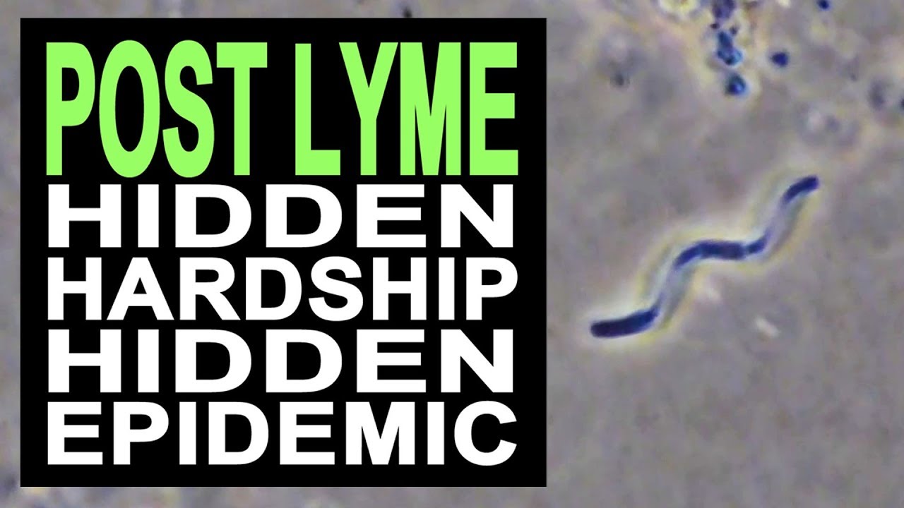 Post Lyme Trailer Free Lyme Disease Documentary YouTube