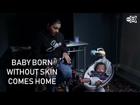 Video: A Baby Without Skin Was Born In The USA - Alternative View