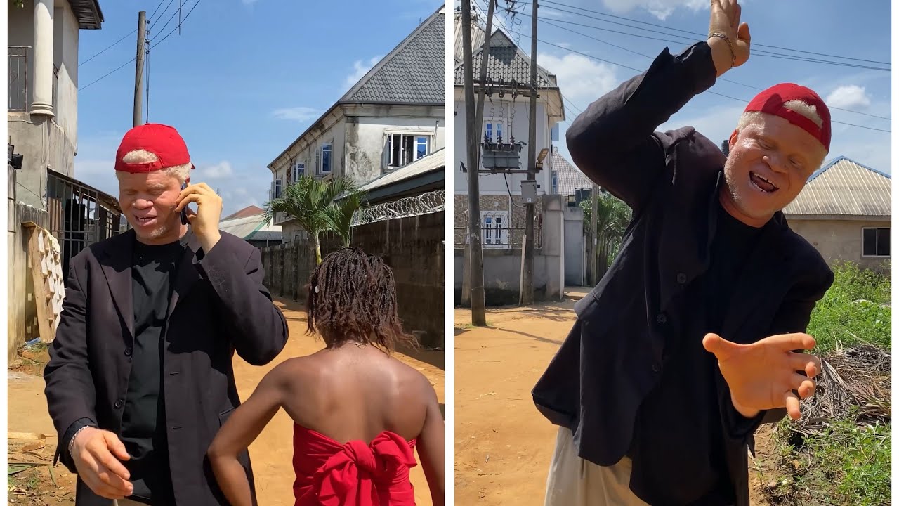 Альбинос может видеть богов 😂😂😂