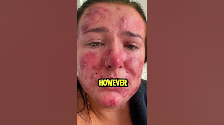 Never use Vaseline again! #shorts #story #awesome #funny