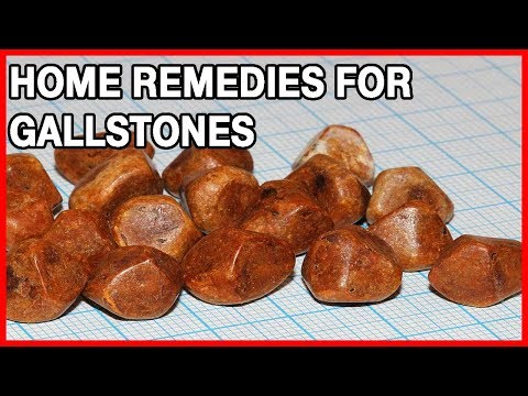 Gallstones Symptoms, Causes and Treatment @HealthWebVideos