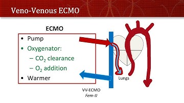 Thinking Simple - ECMO!
