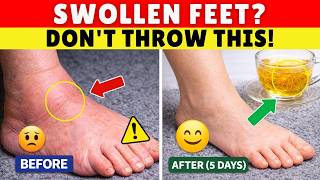 Over 60? Drink THIS to Stop Swollen Legs & Ankles Fast