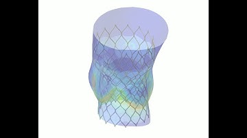 Demo of TAVI deployment simulations using the virtual geometries and a high-fidelity model